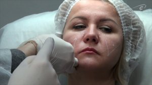 Готовим шприц и работаем скальпелем. Контурная пластика обучение Princess