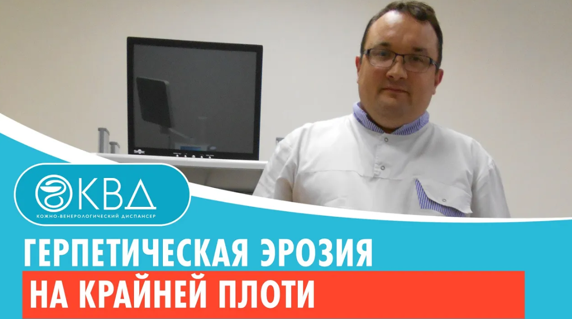 ? Герпетическая эрозия на крайней плоти. Клинический случай №508