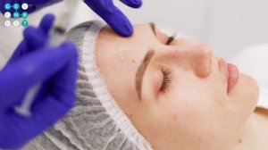 PRX 2.0 Dermal Boost (PRX-t33) Сеть клиник косметологии GEN87