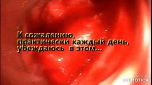 Рак прямой кишки