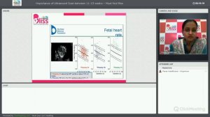 Webinar - Importance of Ultrasound Scan - 11 -13 weeks - Paras Bliss