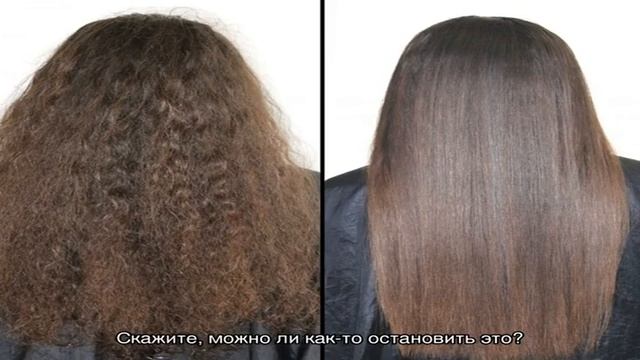 Очень сильно выпадают волосы после рождения ребенка: что делать? смотреть онлайн