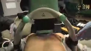 Аппарат Лукаса в действии. Видео из Канады