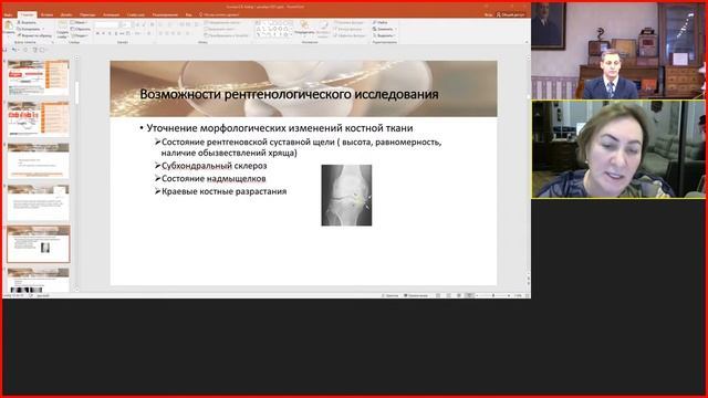 «Ранний остеоартрит- почему важно выделять подобную клиническую форму ».mp4