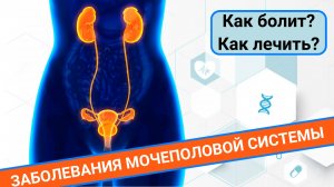 ЗАБОЛЕВАНИЯ МОЧЕПОЛОВОЙ СИСТЕМЫ ЖЕНЩИН. КАК ЛЕЧИТЬ? КАК БОЛИТ?