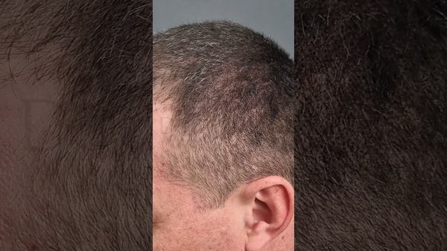 Cкажи залысинам НЕТ ❌ Пудра Sevich — камуфляж, маскировка седины, залысин #shorts #hair #волос смотреть онлайн