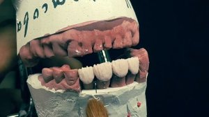 Noritake EX3 / Процесс изготовления металлокерамики.