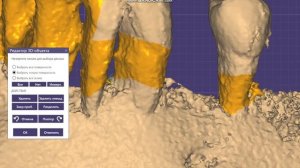 Генерируем 3D объект из КТ. ExoPlan ➜ ExoCad