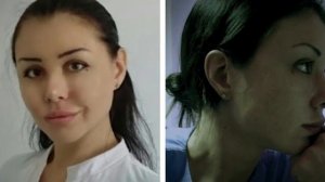 Не буду я сидеть. Лежать буду! Шокирующие подробности кончини Алены Верди: "Доктор франкенштейн"