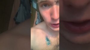 Снять швы самостоятельно