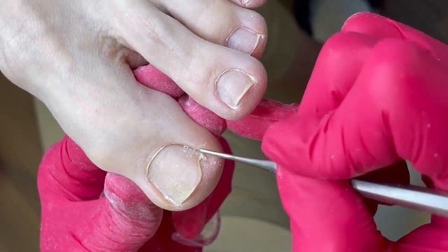 Подологический педикюр смотреть онлайн