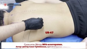 Сухая игла. Latissimus dorsi. ШИРОЧАЙШАЯ МЫШЦА СПИНЫ. Безопасная постановка иглы.