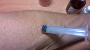 Как избавиться от клеща