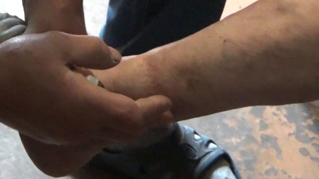 Доктор Пронин: РАК ИЗЛЕЧИМ
