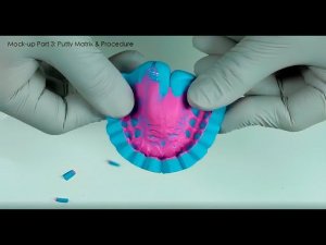 Создание mock-up с использованием 3Shape Dental System