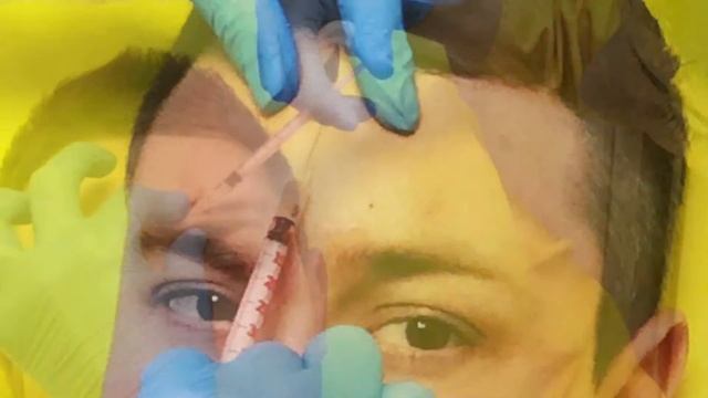 Ботокс Botox