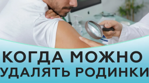 Когда можно удалять родинки
