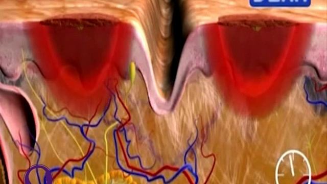Фракционный лазер. №1. +лого_1 смотреть онлайн