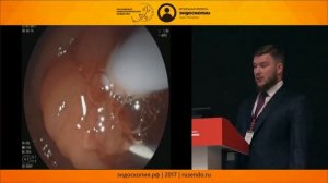 Из наружного во внутреннее билиарное дренирование: трудности перевода