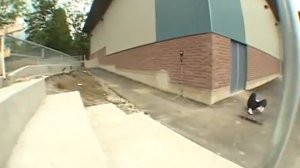 Самые жосткие переломы и ушыбы скейтеров