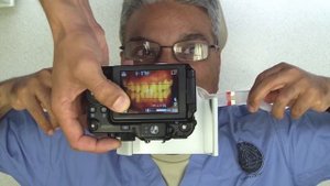 Dental Photography - The Basics