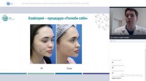Запись вебинара: Система революционных ревитализирующих пилингов AESTHETICAL (Италия)