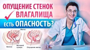 Что происходит с маткой после родов_ Опущение стенок влагалища - опасно ли_.mp4