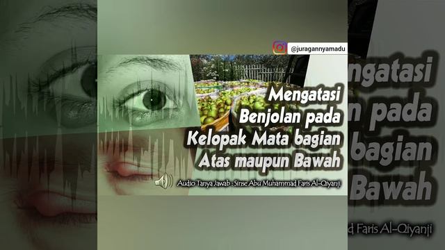 BAGAIMANA CARA MENGATASI BENJOLAN PADA KELOPAK MATA BAGIAN ATAS MAUPUN BAWAH ? | APAKAH ANDA JUGA смотреть онлайн