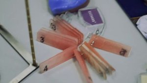 Стратегия и тактика достижения успеха в тотальном, съёмном и несъёмном протезировании.mp4