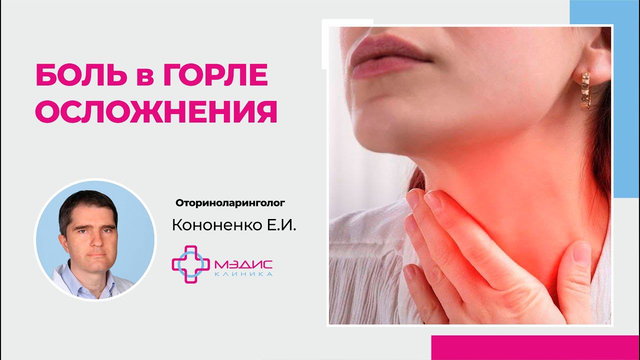 115.11. Потеря голоса после боли в горле. Кононенко Евгений Игоревич, ЛОР