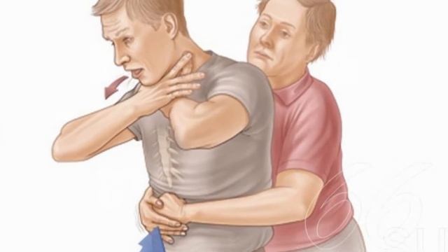 10 ОШИБОК ПРИ ОКАЗАНИИ ПЕРВОЙ МЕДИЦИНСКОЙ ПОМОЩИ смотреть онлайн