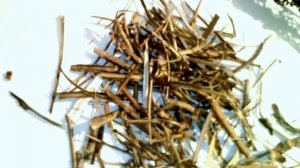 ПОНИЖАЕМ САХАР В КРОВИ.СТВОРКИ ФАСОЛИ, ВЕТКИ ШЕЛКОВИЦЫ,ТОПИНАМБУР И ДР. НАРОДНАЯ МЕДИЦИНА.