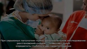 Заячья губа: причины, диагностика, лечение