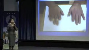 Системная красная волчанка СКВ и пневмония   как помог Трансфер Фактор