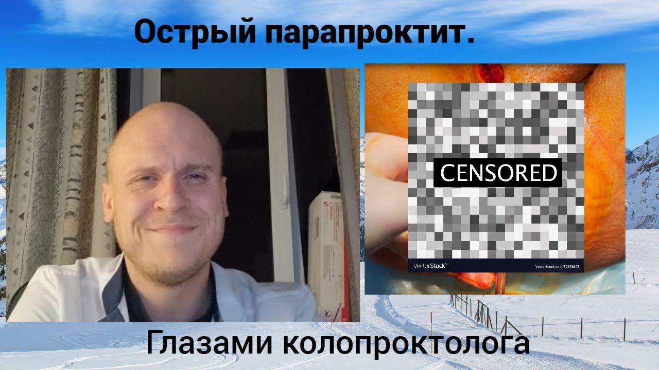 Острый парапроктит. Глазами колопроктолога.