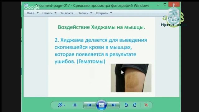 Воздействие хиджамы на мышцы смотреть онлайн