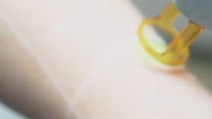 laser best 85715159 148055823325320 6476692088370287790 n