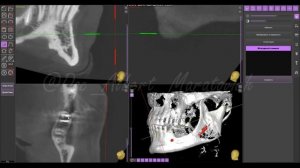 #ОПТГ или #КЛКТ (#КТ)