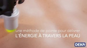 Motus AX avec pièce à main MOVEO - La véritable révolution dans l’univers de l'épilation au laser