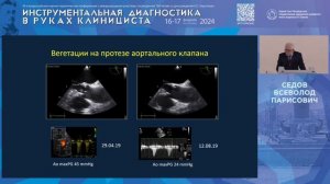 Ультразвуковая диагностика патологических эхопозитивных образований сердца