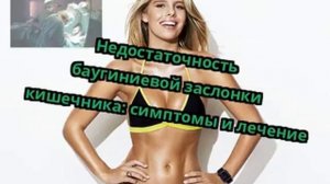 Недостаточность баугиниевой заслонки кишечника: симптомы и лечение