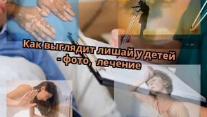 Как выглядит лишай у детей - фото, лечение