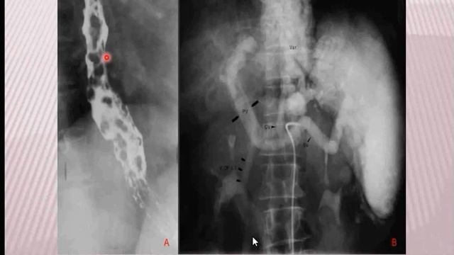 Contrast Examination of GIT | Radiology смотреть онлайн