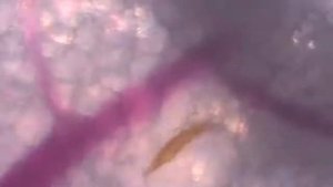 КОМАР СОСЁТ КРОВЬ УВЕЛИЧЕНИЕ В 30 РАЗ