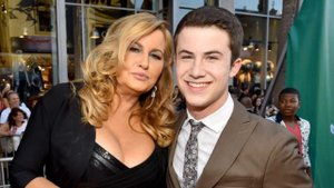 Как менялся Дилан Миннетт