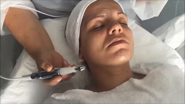 DermoJet Видео Протокол терапия за лице смотреть онлайн