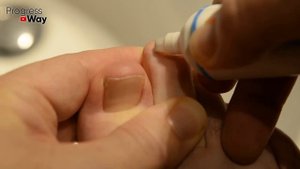 Эта ЯДРЁНАЯ Советская Мазь Разъест Весь Грибок с Ногтей! Есть в Любой Аптеке!