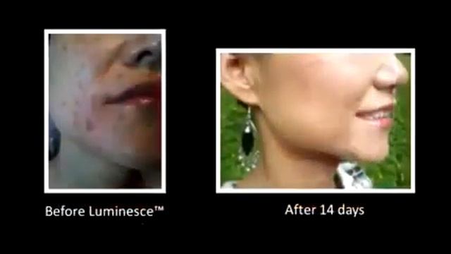 Как избавиться от морщин,пигментных пятен и шрамов. смотреть онлайн