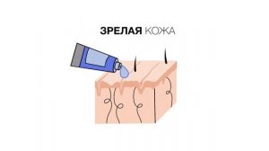 Строение дермы