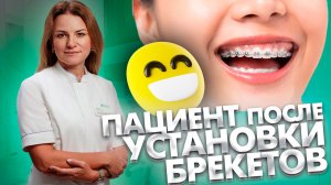 Какие эмоции испытывают пациенты при установке брекетов, сразу после окончания лечения и снятия?